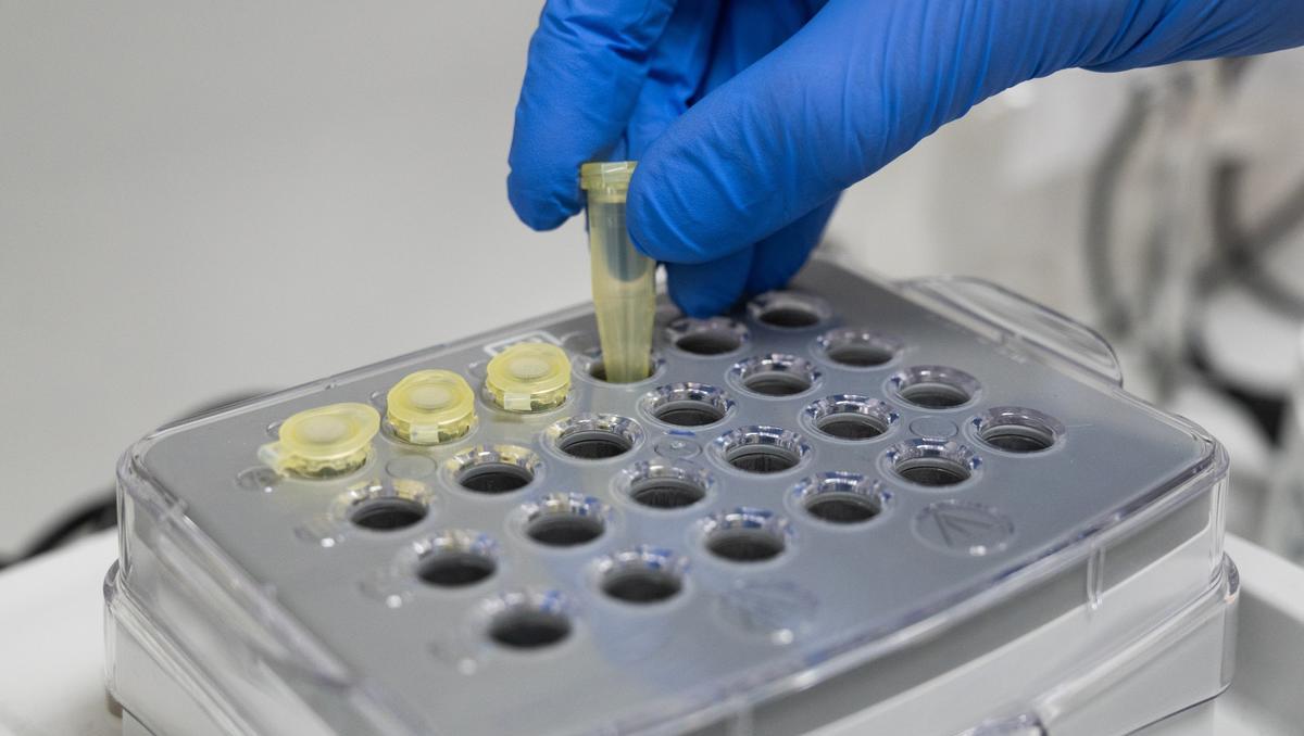 WHO-Expertenrat fordert Prüfung von Laborthese zum Virus-Ursprung