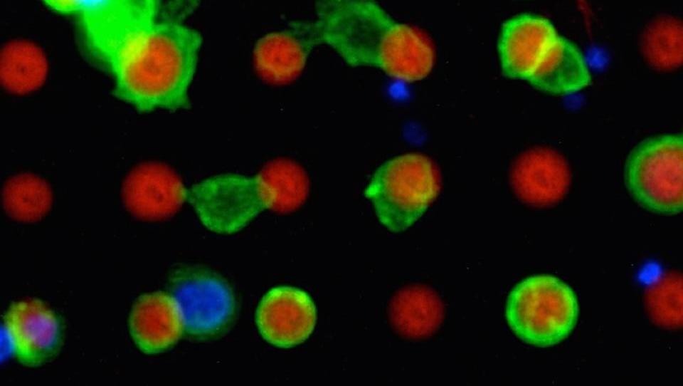 Forscher können einzelne Krebszellen finden und isolieren